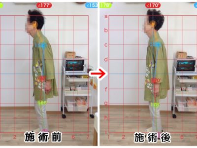 姿勢改善