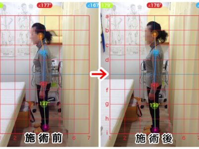 腰の痛み、背中の痛み